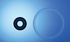 KAMRA Inlay For Presbyopia