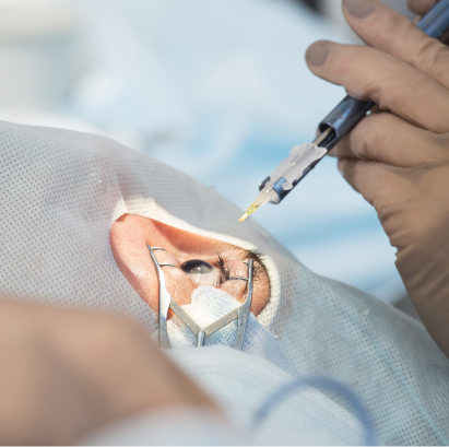 Is Lasik safe? What the latest technology means for your eyes