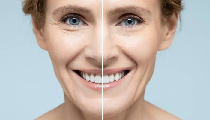 Skin Tightening in Boston